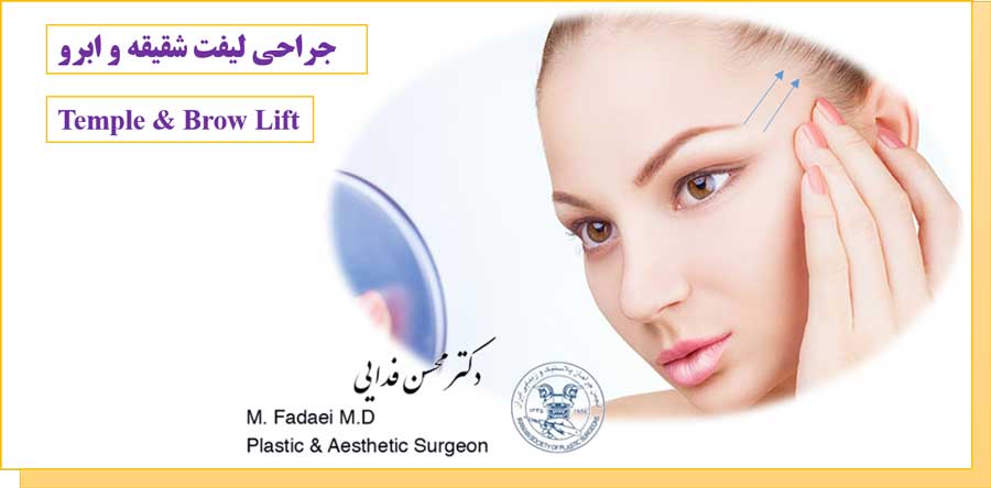 لیفت شقیقه و ابرو - Temple & Brow Lift - سحب العین