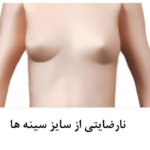 ترمیم مجدد سینه