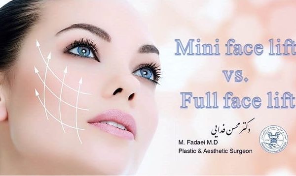 mini face lift vs. full face lift