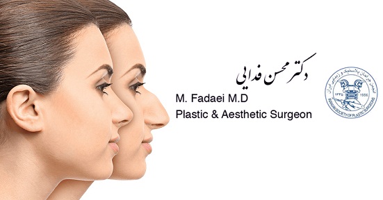 Bony Nose Surgeries