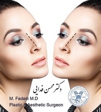 جراحی ریویژن بینی