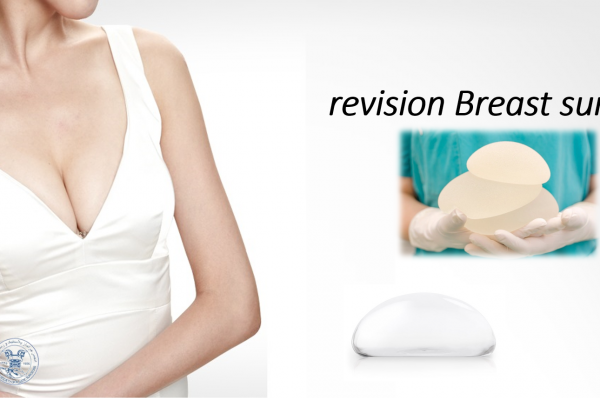 revision Breast surgery