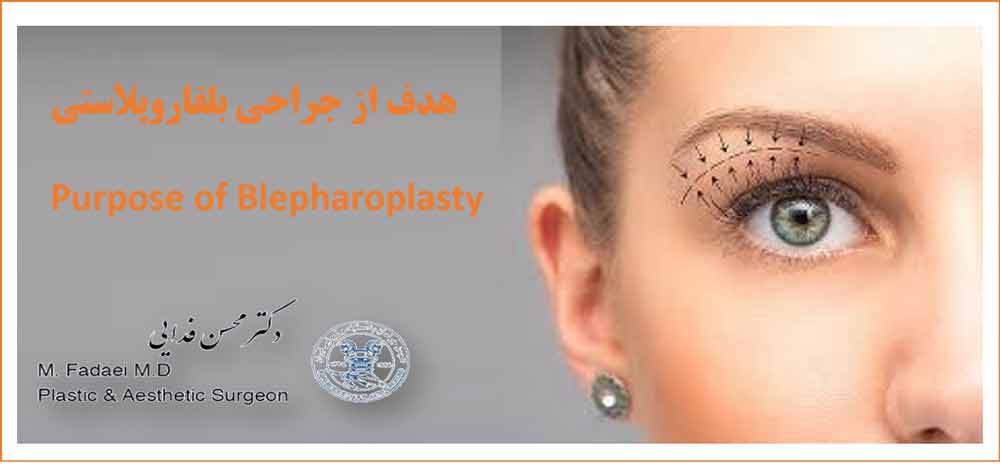 بلفاروپلاستی blepharoplasty