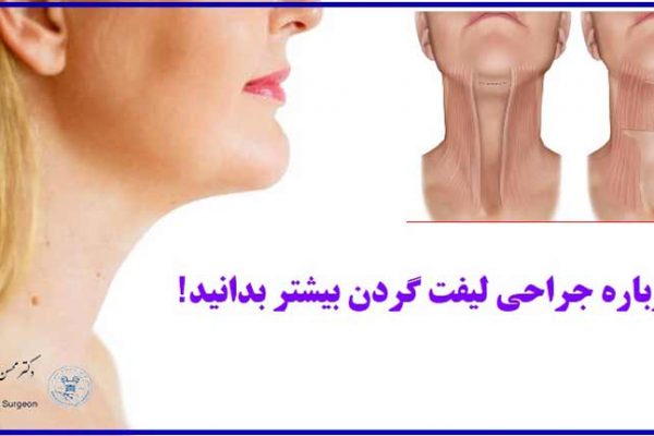 درباره جراحی لیفت گردن بیشتر بدانید