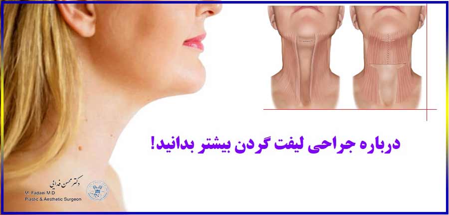 درباره جراحی لیفت گردن بیشتر بدانید