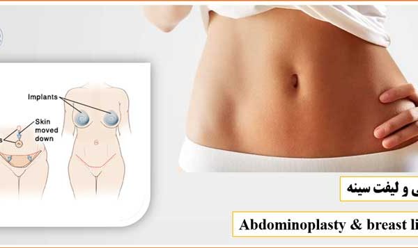 جراحی ابدومینوپلاستی و لیفت سینه - Abdominoplasty and breast lift surgery