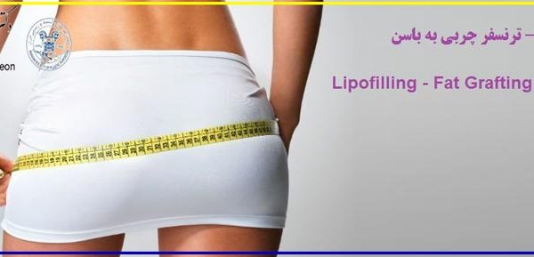 لیپوفیلینگ - Lipofilling