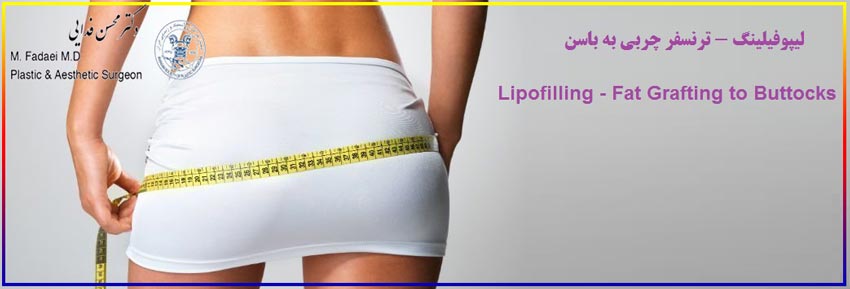 لیپوفیلینگ - Lipofilling