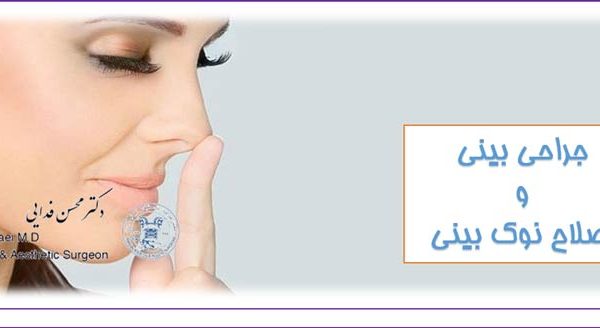 اصلاح نوک بینی (tip plasty)