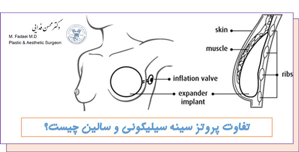 عوارض جراحی پروتز سینه