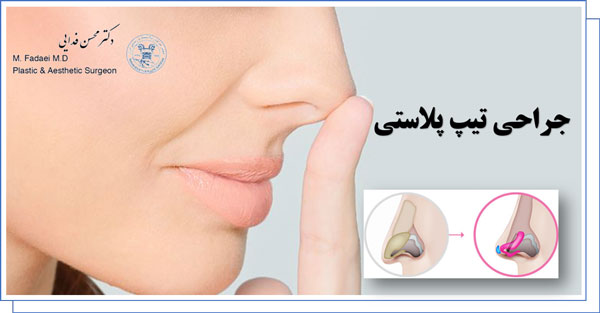 جراحی تیپ پلاستی (tip plasty)