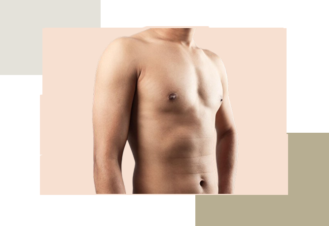 ژنیکوماستی