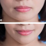 close up of surgery woman