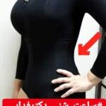 لیپوماتیک - پیکرتراشی