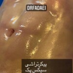 لیپوماتیک سیکس پک
