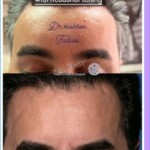 جوانسازی صورت