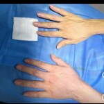 جوانسازی دست